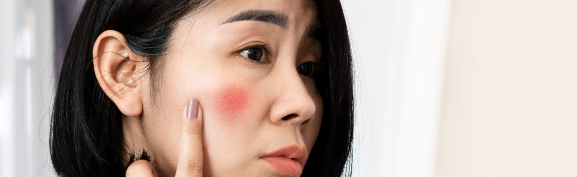 Dealing with Skin Redness? Here’s what you need to know… | Fièra Cosmetics
