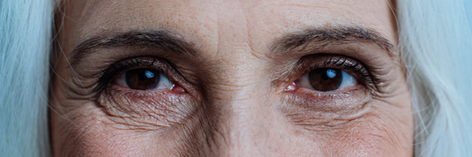 How to Visibly Fade Age Related Dark Circles on Mature Skin