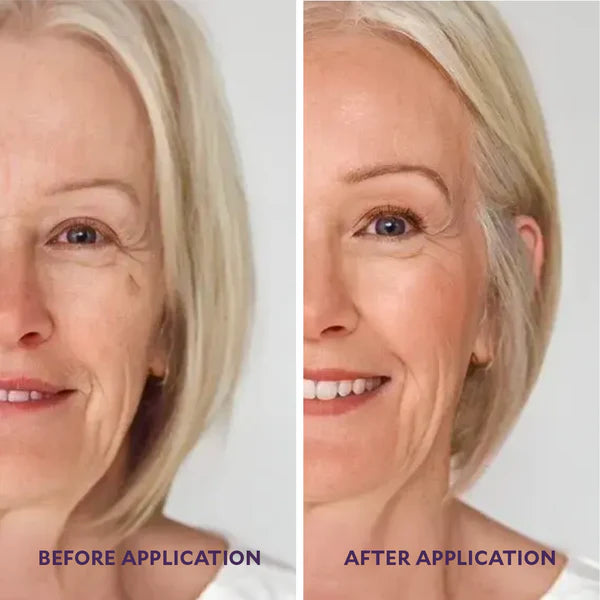 Before and After Results