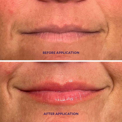 Fulluptuous™ Lip Plumper + Hydrator