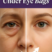 How to Get Rid of Under Eye Bags - Free Ebook